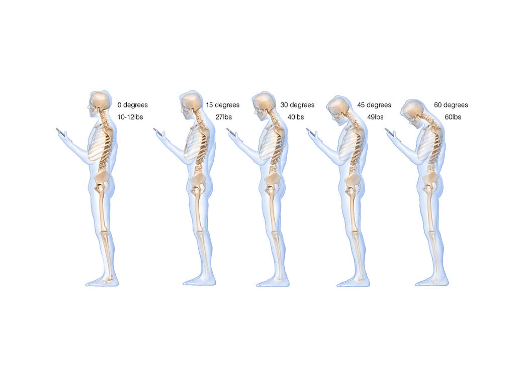 Tech Neck Pain While Using Phone